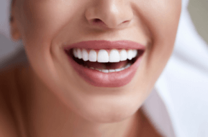 Woman with white teeth from whitening at our Derby practice