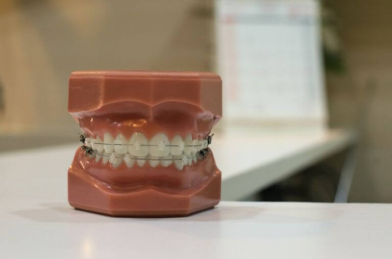 Dental model of gums and teeth on desk in clinic