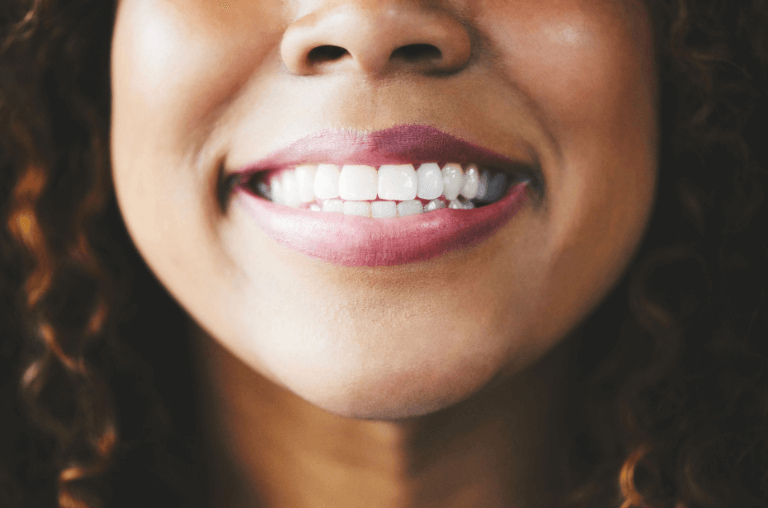 Woman with teeth whitening, white teeth smiling