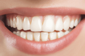 close up of a smile showing teeth and lips